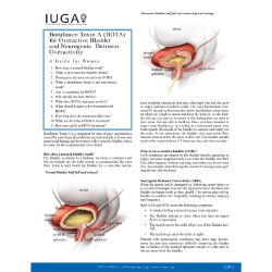Botulinum Toxin