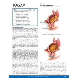 Fecal Incontinence