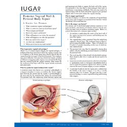 Posterior Vaginal Wall & Perineal Body Repair