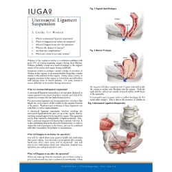 Uterosacral Ligament Suspension